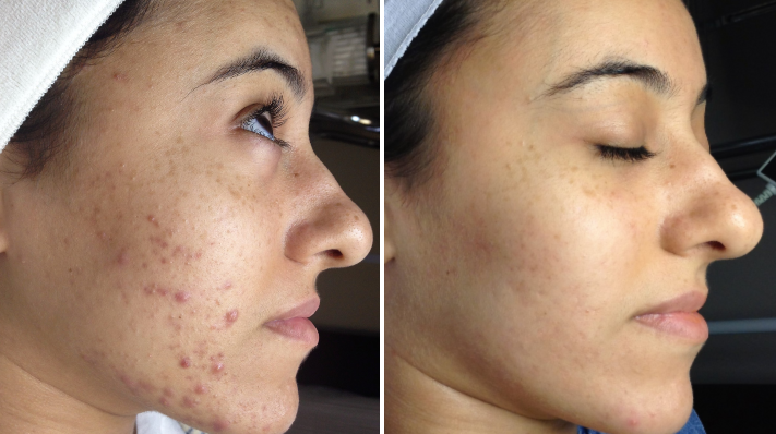 Pressa A Compressione - 100 Ton - 500x550 Mm - BM Monza - C2 Macchine Gomma - Foto 6